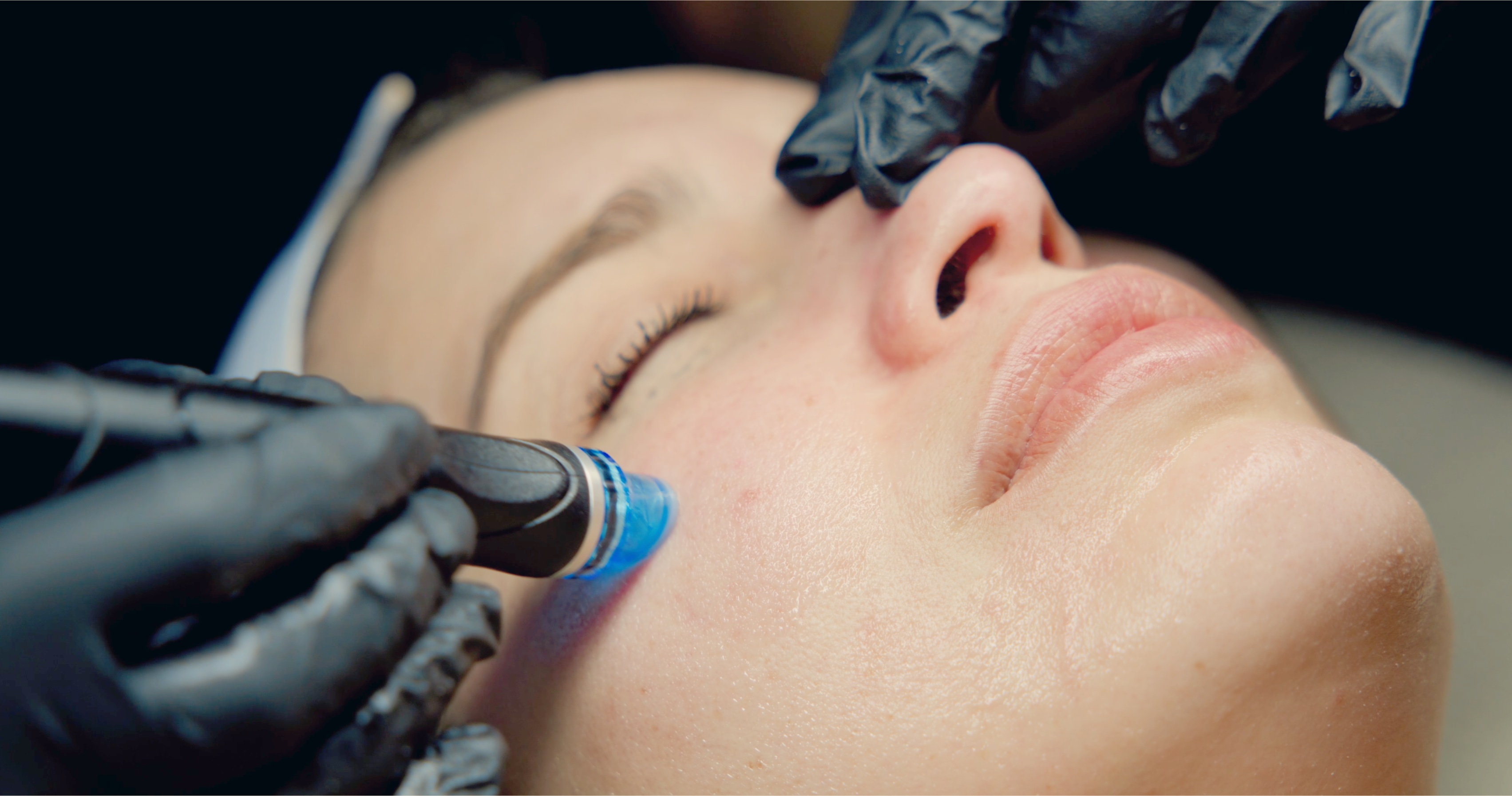 HydraFacial