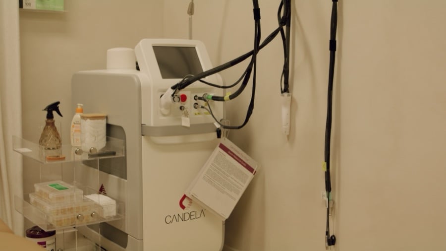 Laser hair removal treatment being performed at AMMA Aesthetics in South Miami