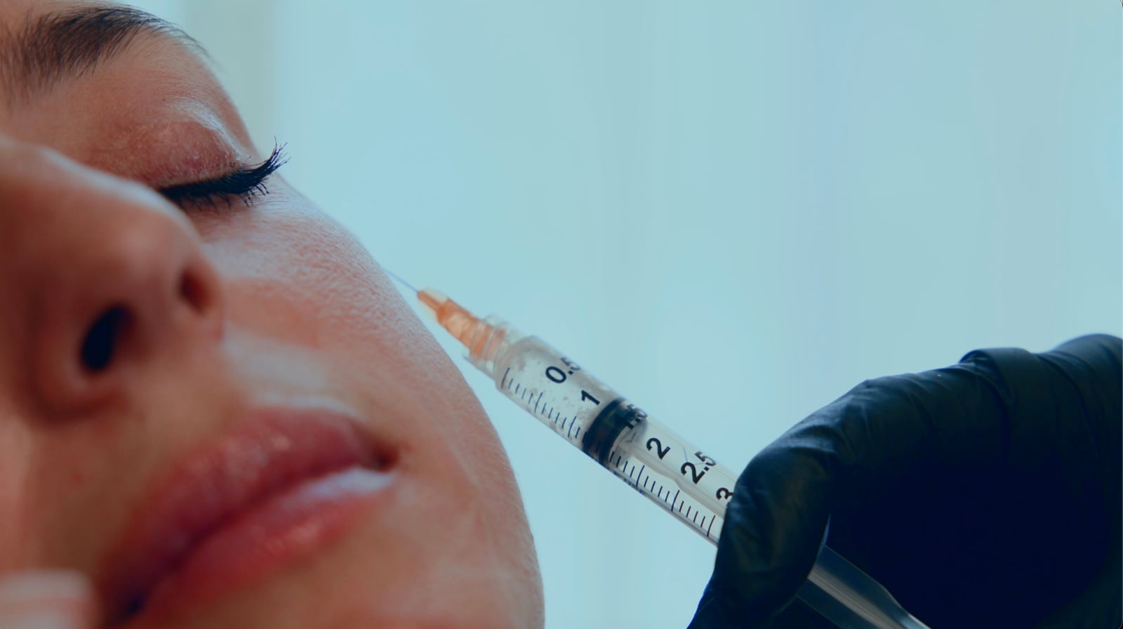 EZ-Gel PRF injection placed under the eye at AMMA Aesthetics in Miami