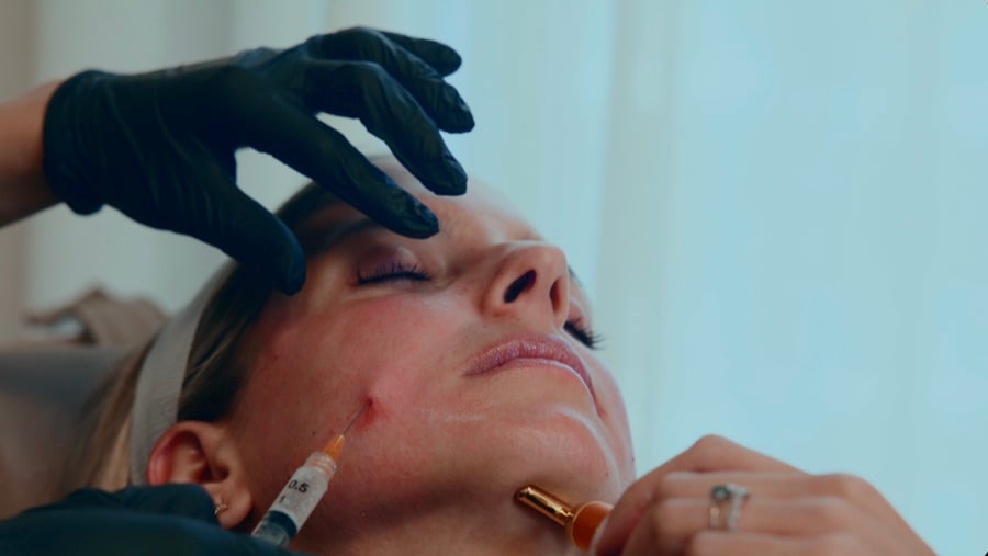 Hair Restoration at AMMA Aesthetics in South Miami